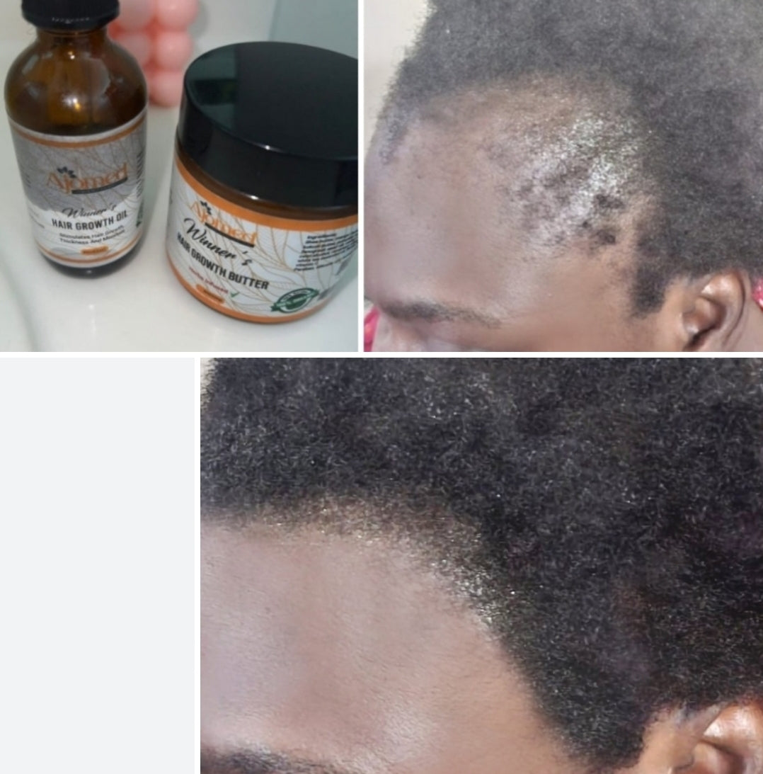 Rosemary & Fenugreek Seed Hair Growth Oil - 2flOz