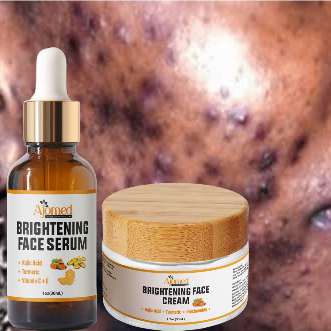 Kojic Acid & Turmeric Brightening Face Serum with Alpha Arbutin. Handmade Face serum 1oz