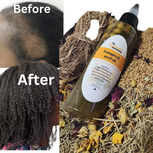 Fenugreek Rosemary & Peppermint hair growth oil. 8Oz